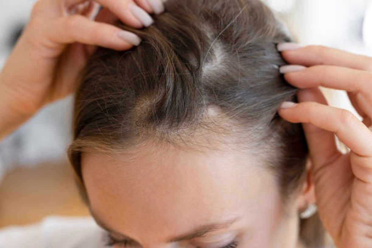 Redensyl vs Capixyl for Hair Loss: Benefits & Side Effects