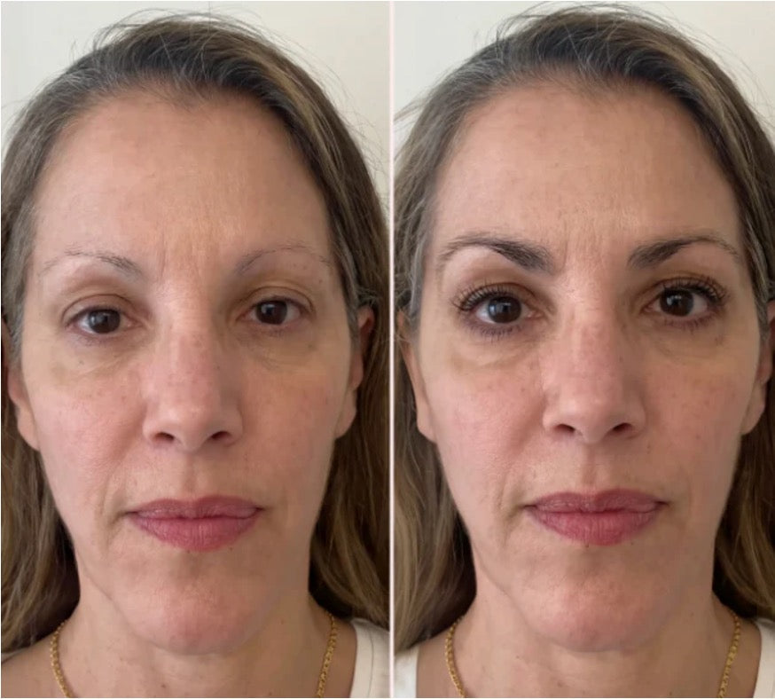 Lashcode vs UKLASH vs Trybello Lash Serum: Cost, Results & Reviews