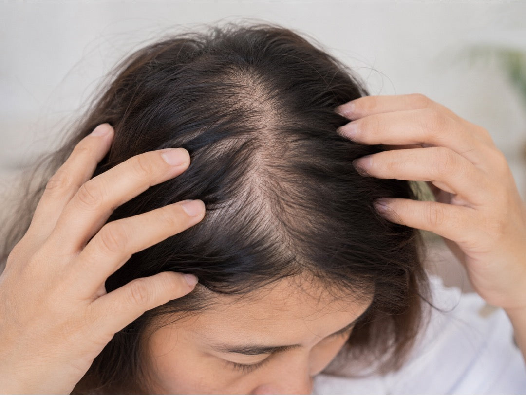 Telogen Effluvium vs Anagen Effluvium: Causes, Timeline & Solutions