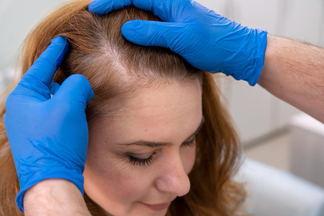 Hair Loss After Egg Freezing: Causes & Treatment Options
