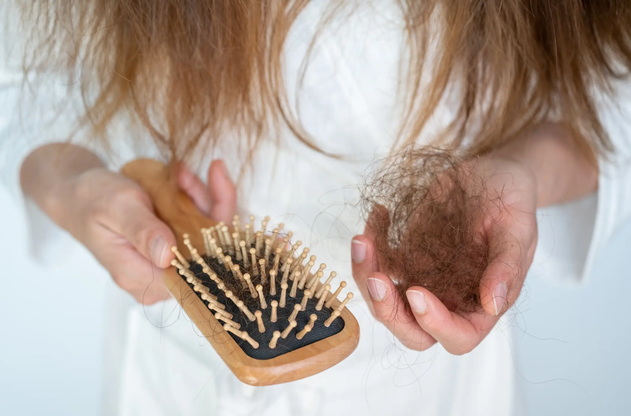 Hair Loss After RSV: Causes, Timeline & Solutions