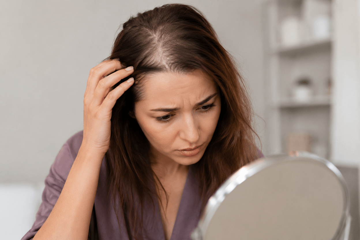 DHT & Hair Loss in Women: Causes, Symptoms & Treatment Options
