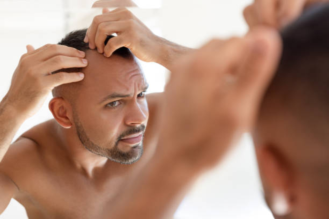 Finasteride vs Caffeine for Hair Loss: Results & Side Effects