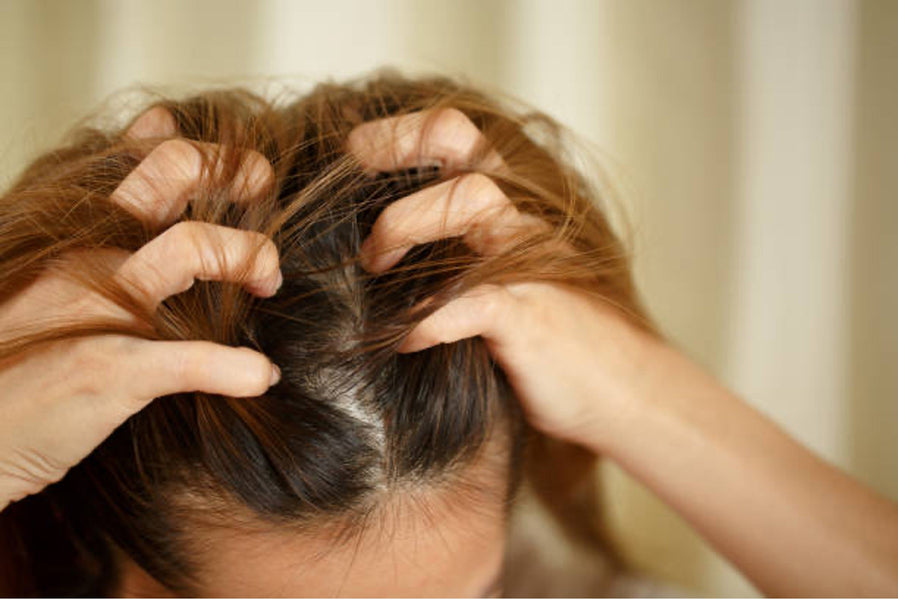 Menopause Itchy Scalp & Hair Loss: Causes & Remedies to Try