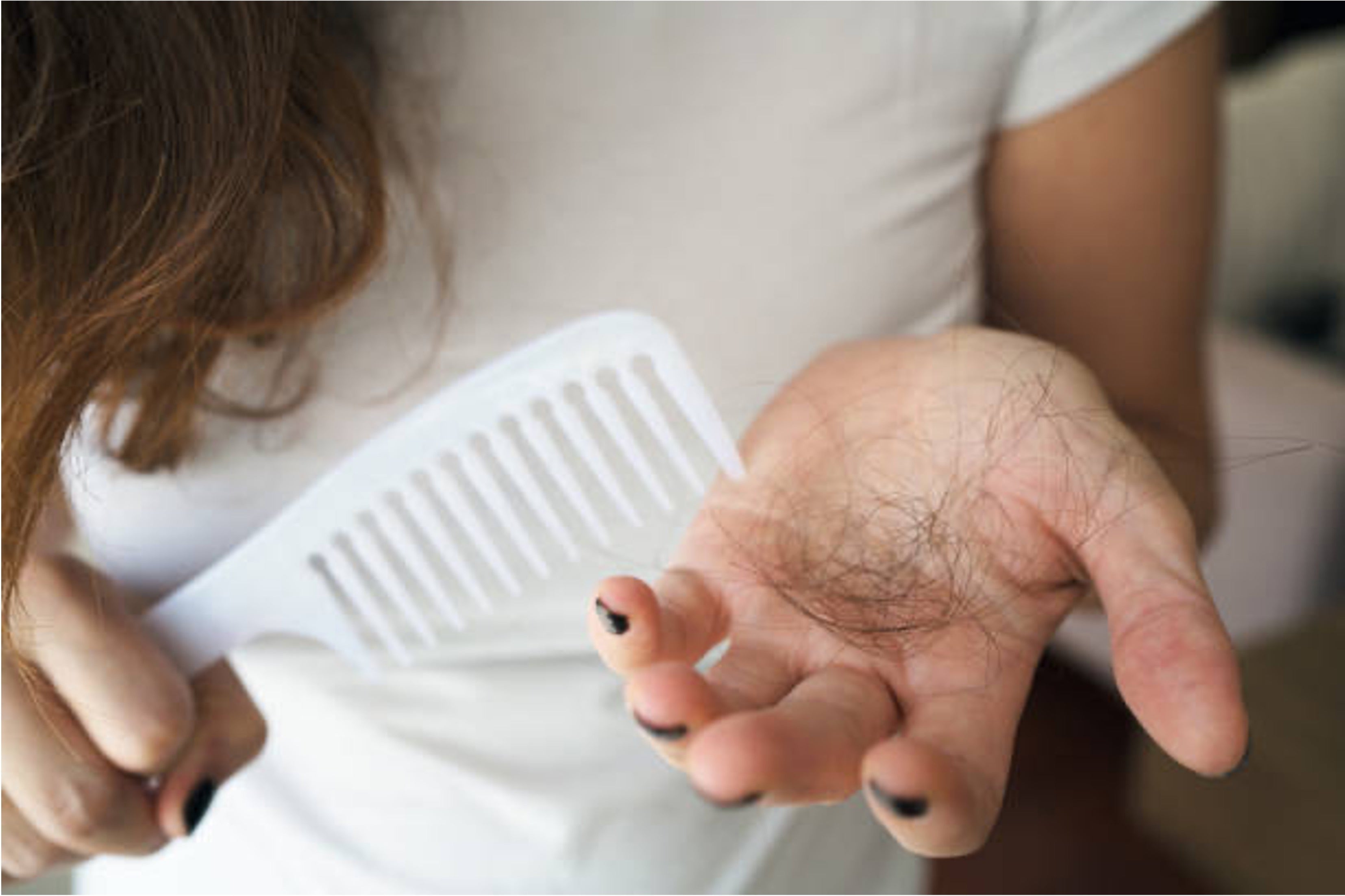 Hair Loss After Bariatric Surgery: Causes & Tips to Prevent Shedding