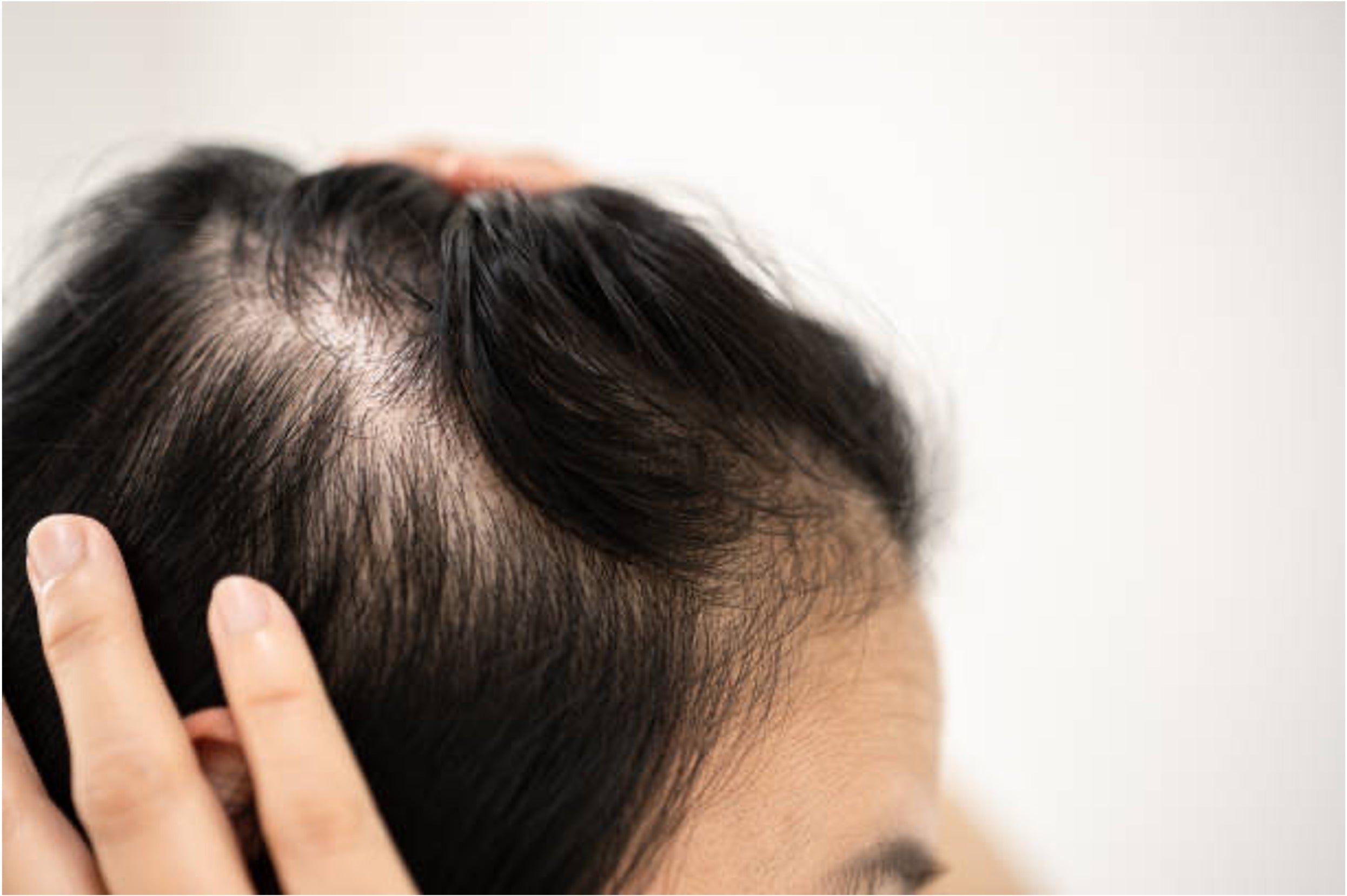 Fine Hair vs Thin Hair: What’s the Difference & How to Tell Your Type?