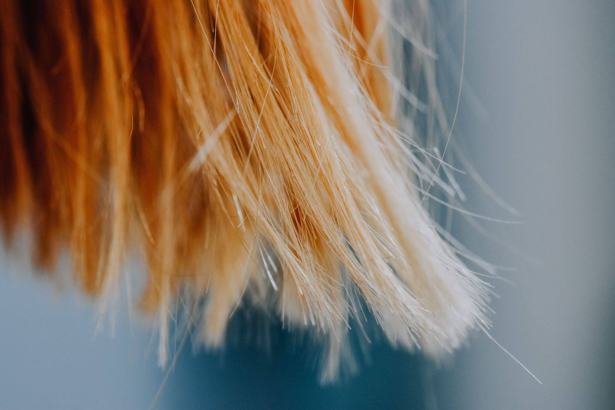 Hair Loss After Food Poisoning: Causes, Timeline & Treatment