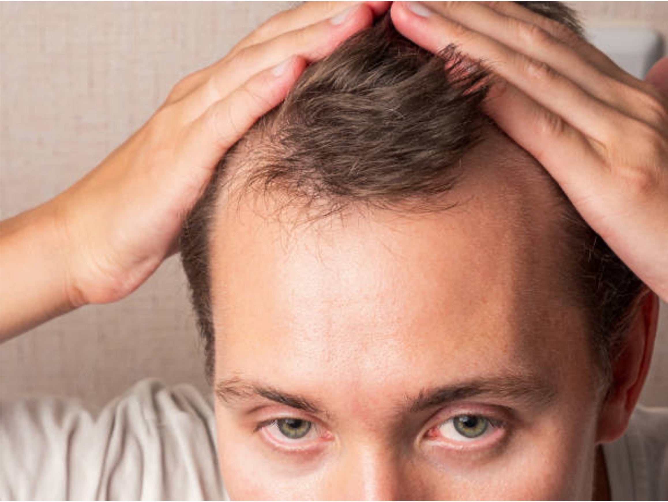 Androgenetic Alopecia Hair Loss: Causes, Timeline & Treatment for Regrowth