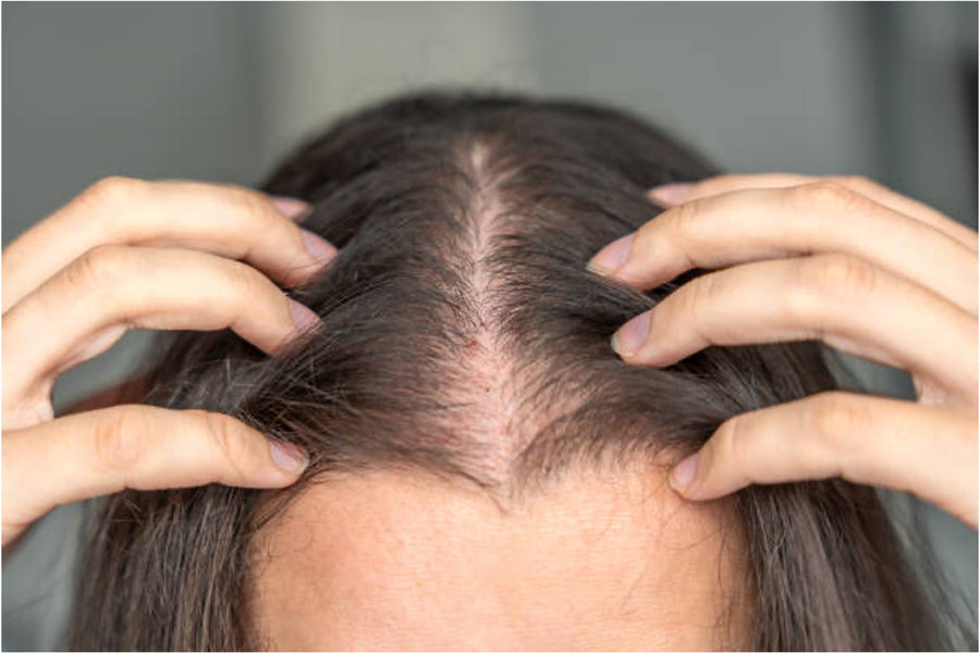 Exosome Therapy vs PRP for Hair Loss: Results, Cost & Side Effects