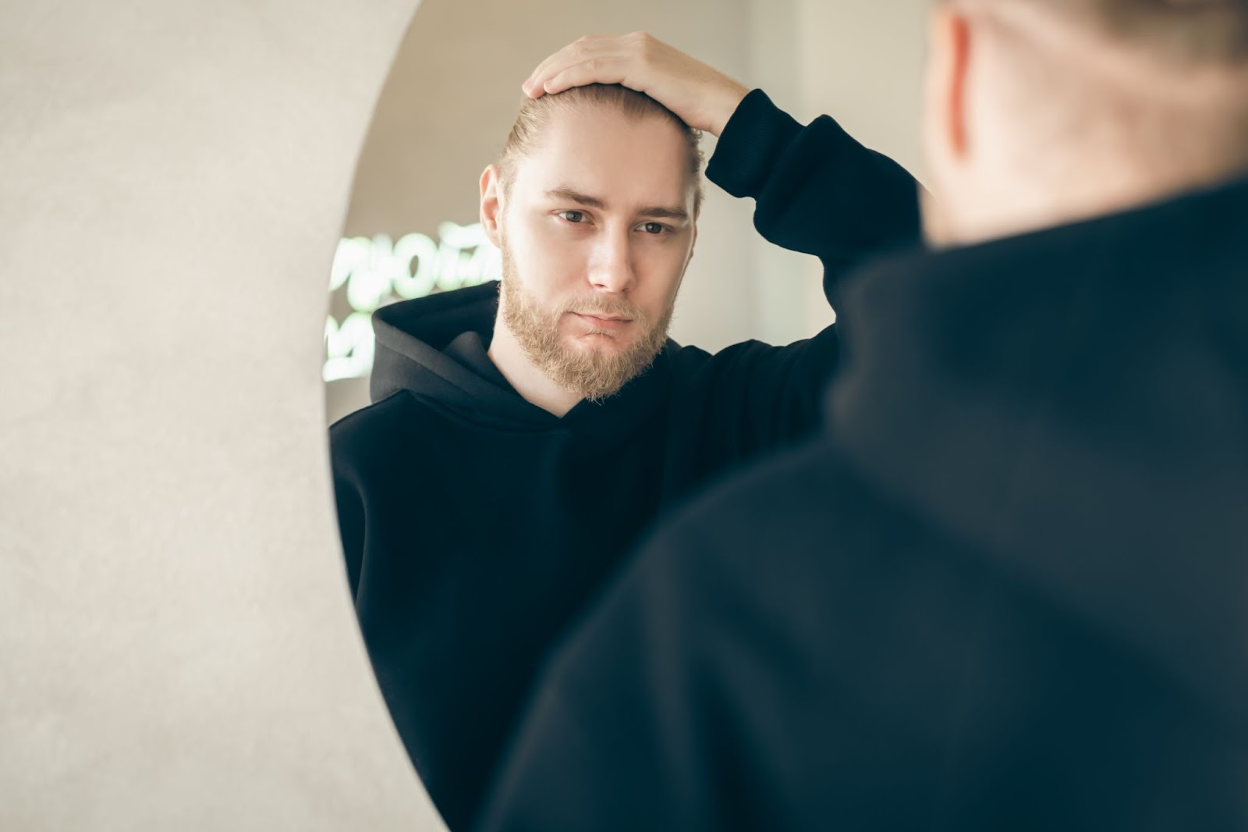 Widow’s Peak vs Receding Hairline: How to Tell the Difference