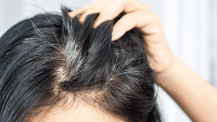 Is Your Scalp Older Than You?