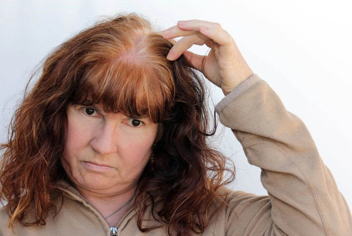 Menopausal Hair Loss And How It Works