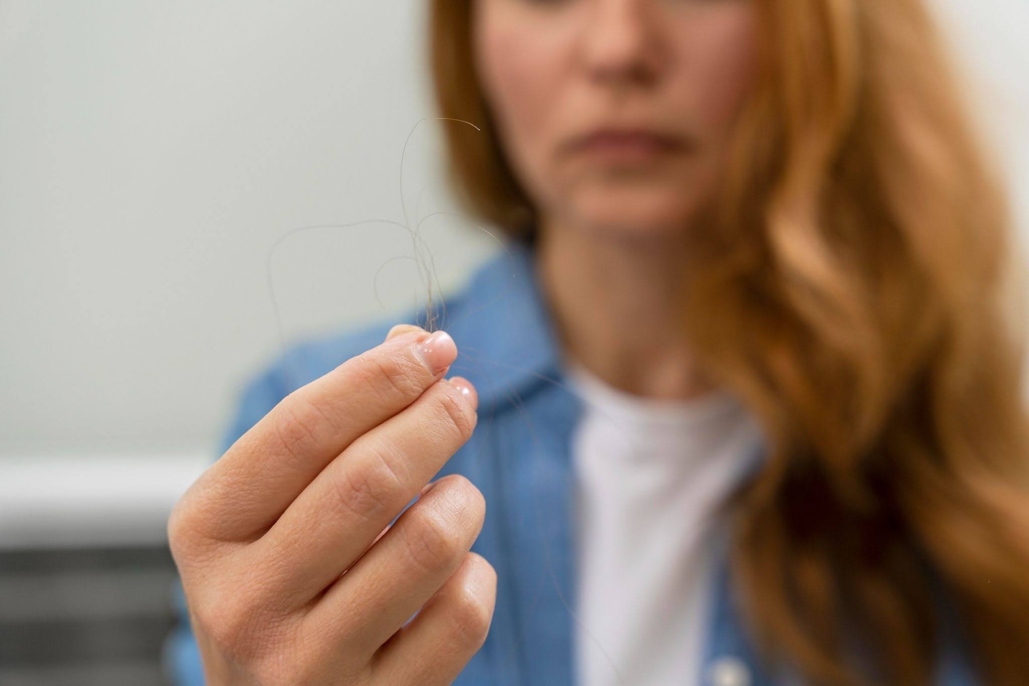 Hair Loss Due To Zinc Deficiency: Causes & Treatment