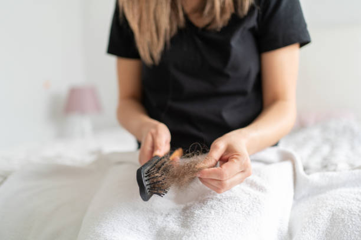 Capixyl™ vs Minoxidil for Hair Loss Treatment: Effectiveness & Side Effects