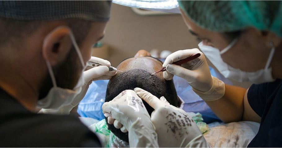 PRP vs Microneedling for Hair Loss: Results, Cost & Side Effects