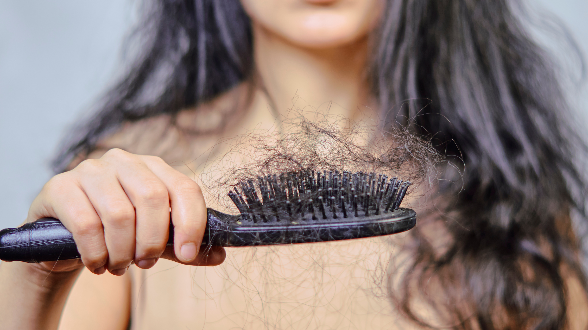 Hair Loss: What is It, Causes, Treatments, and When to Be Concerned