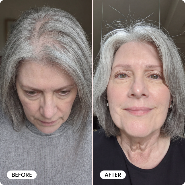 Bello Hair Booster Capsules BOGO