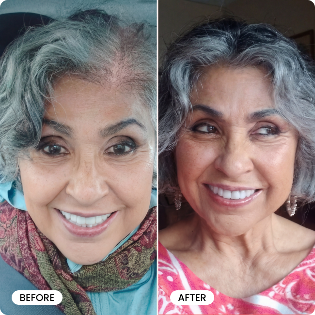 Bello Hair Helper Spray BOGO