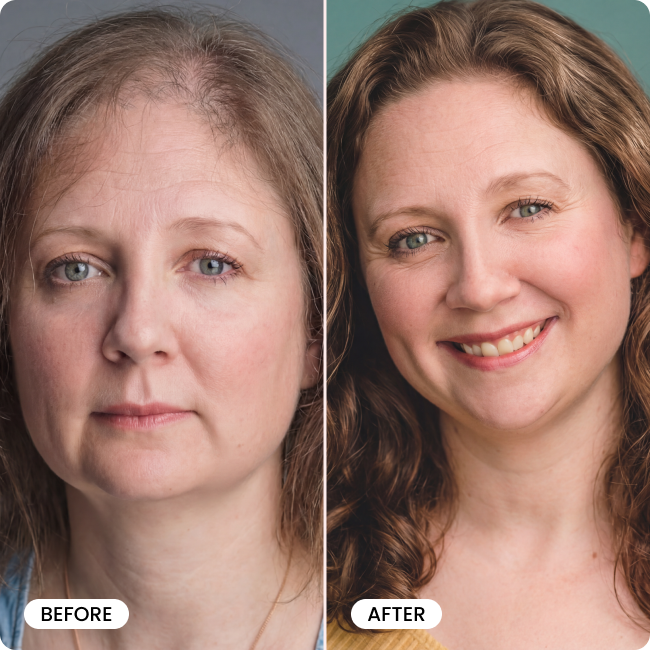 TryBello Hair Growth Conditioner