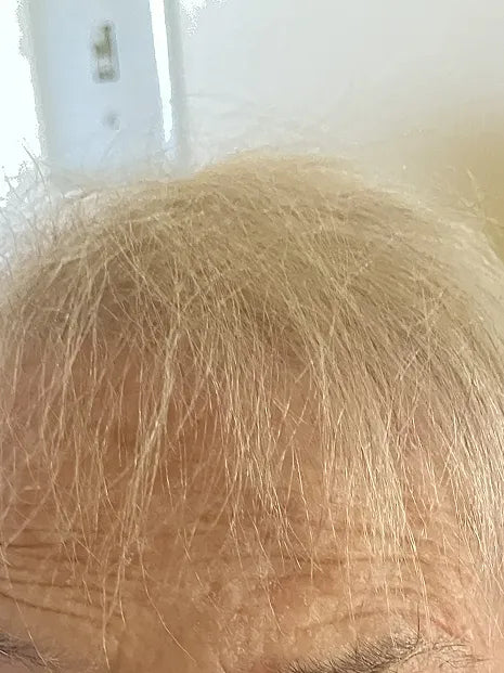 before-img