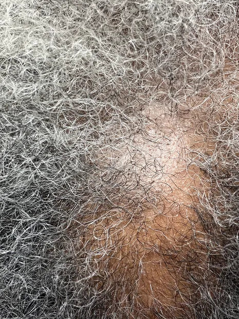 before-img