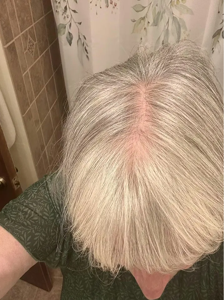 before-img