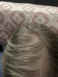 after-img