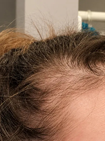 before-img