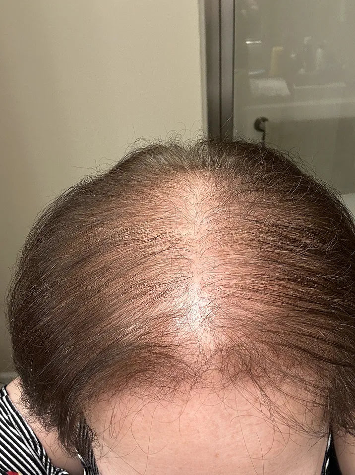 before-img