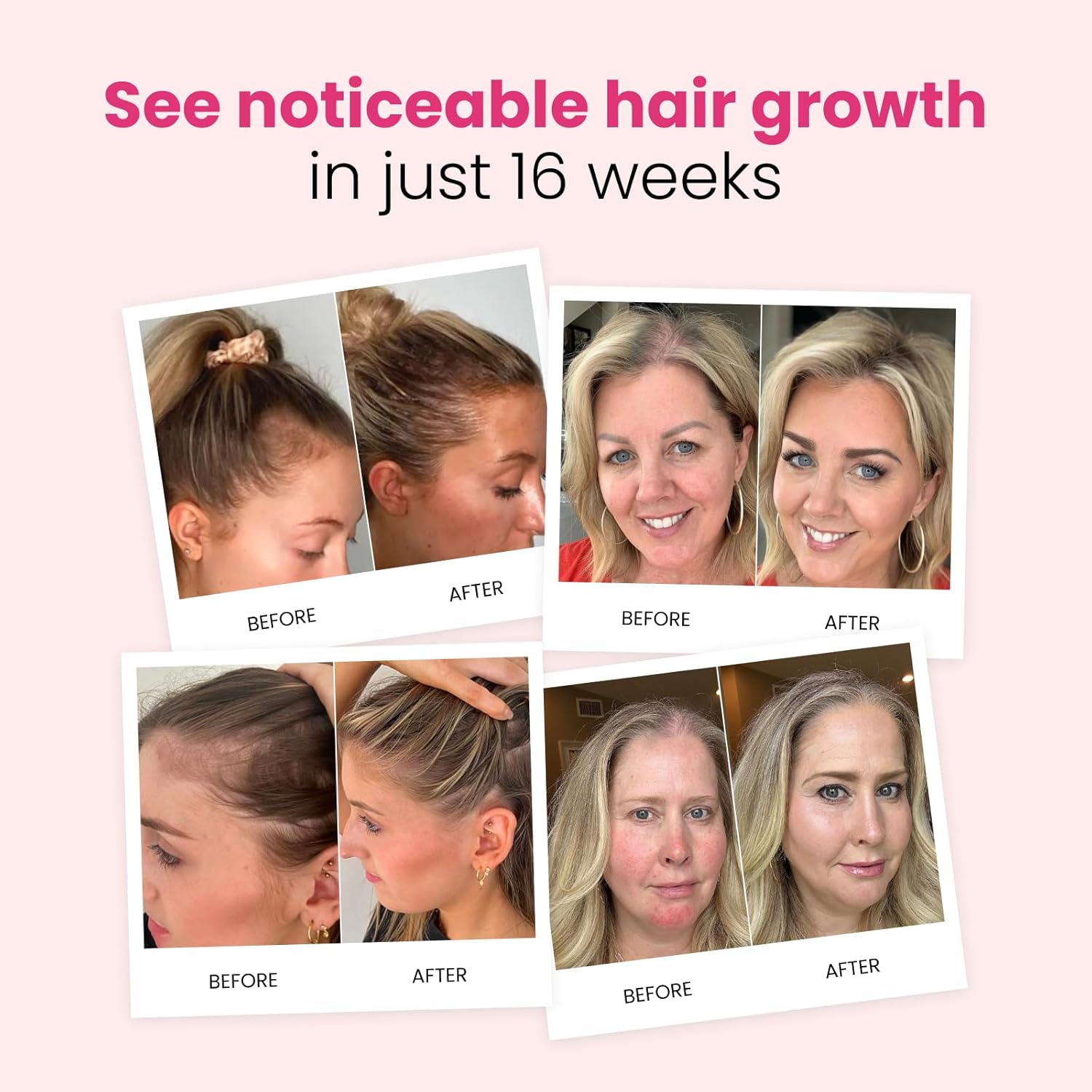 Trybello Hair Growth Shampoo & Strengthening Conditioner Set