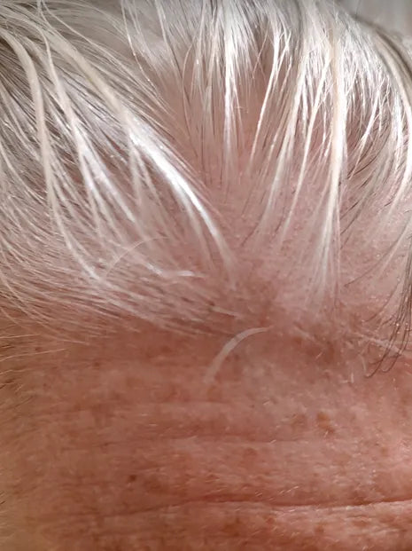 before-img